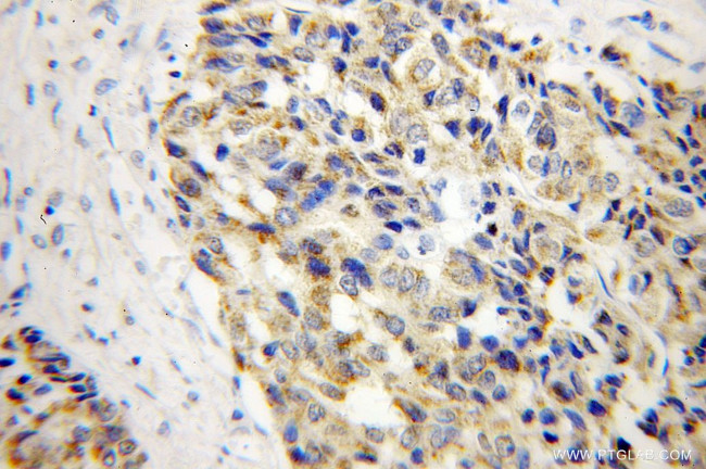 MTHFS Antibody in Immunohistochemistry (Paraffin) (IHC (P))