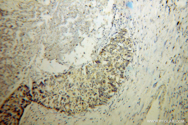 MTHFS Antibody in Immunohistochemistry (Paraffin) (IHC (P))