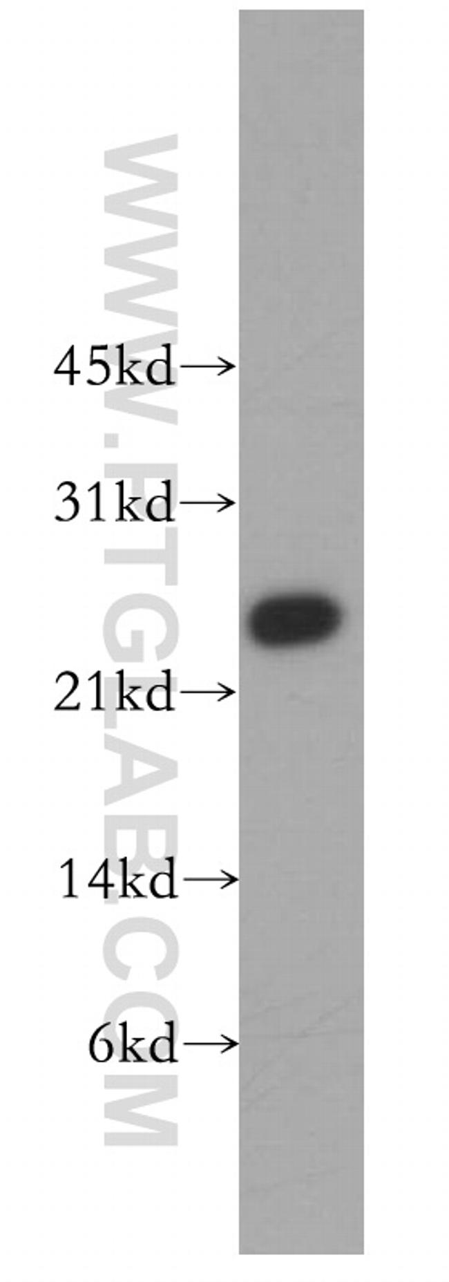 MTHFS Antibody in Western Blot (WB)