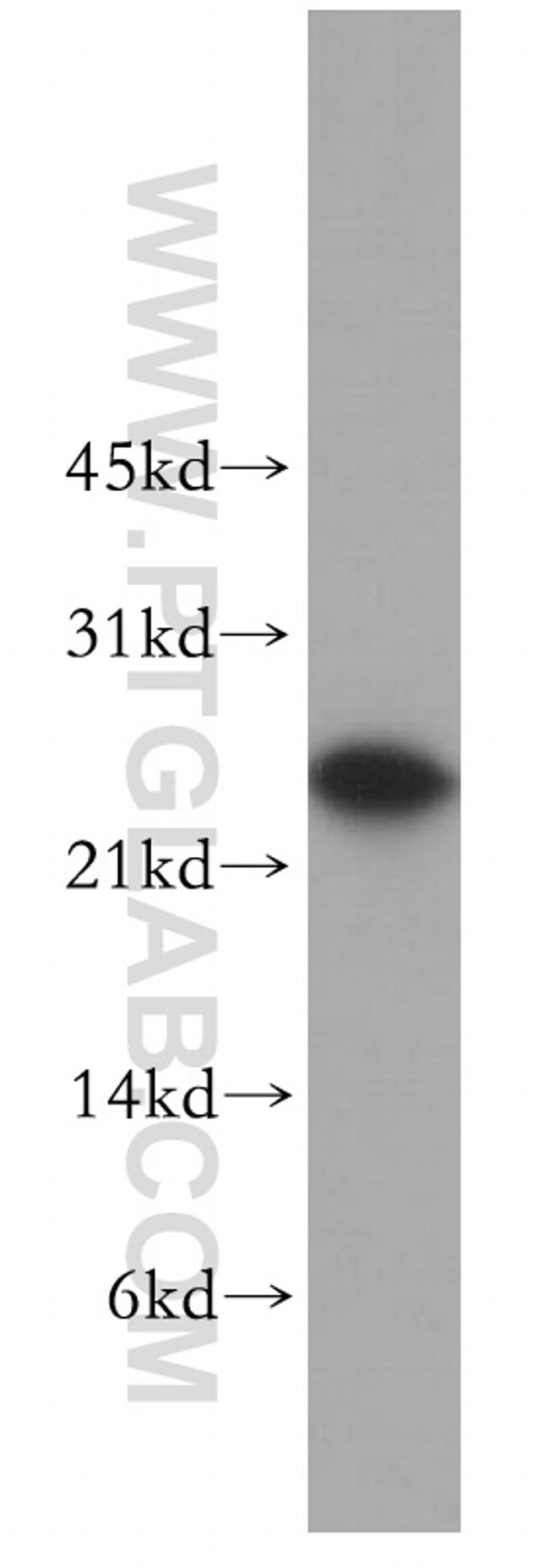 MTHFS Antibody in Western Blot (WB)