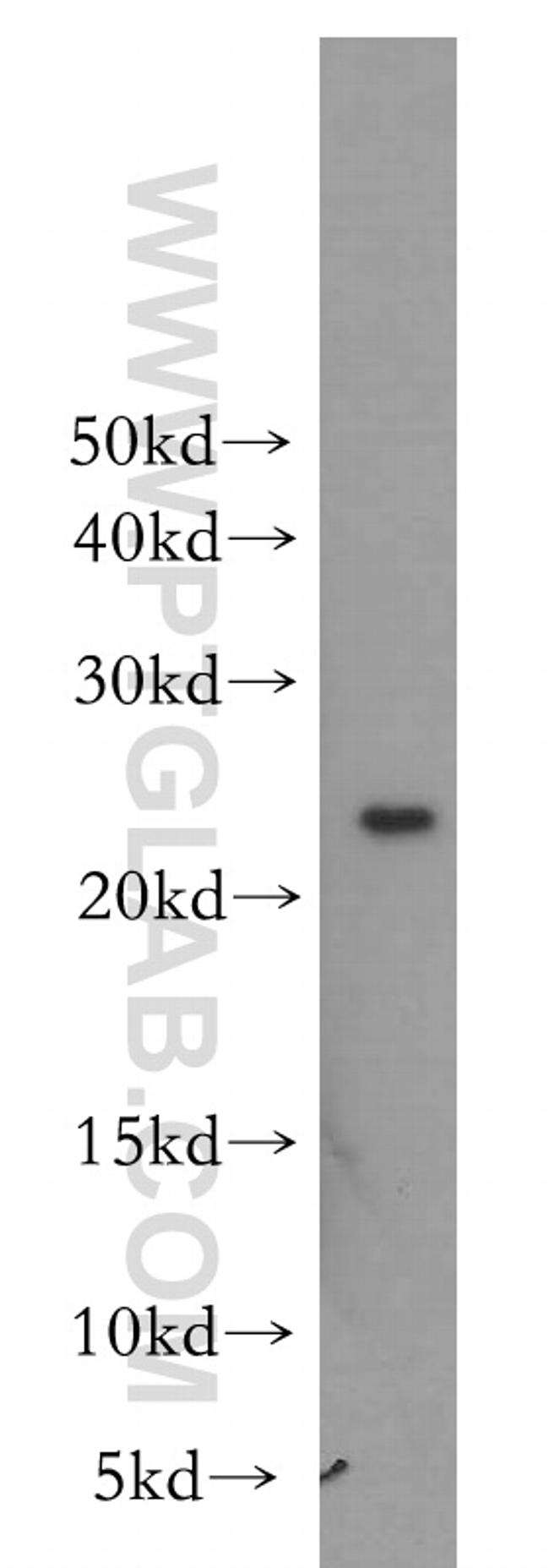 MTHFS Antibody in Western Blot (WB)