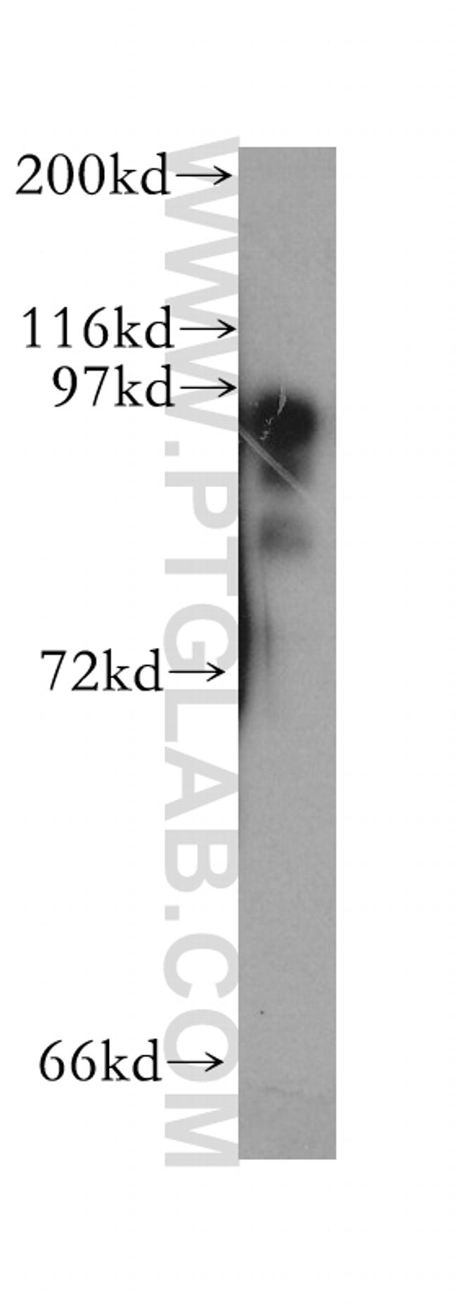 PKD2L1 Antibody in Western Blot (WB)