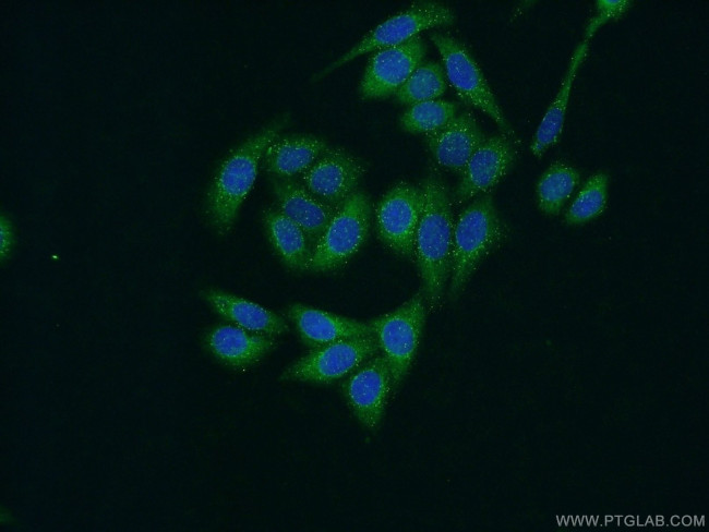 ZFYVE16 Antibody in Immunocytochemistry (ICC/IF)