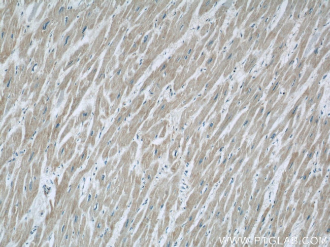 ZFYVE16 Antibody in Immunohistochemistry (Paraffin) (IHC (P))