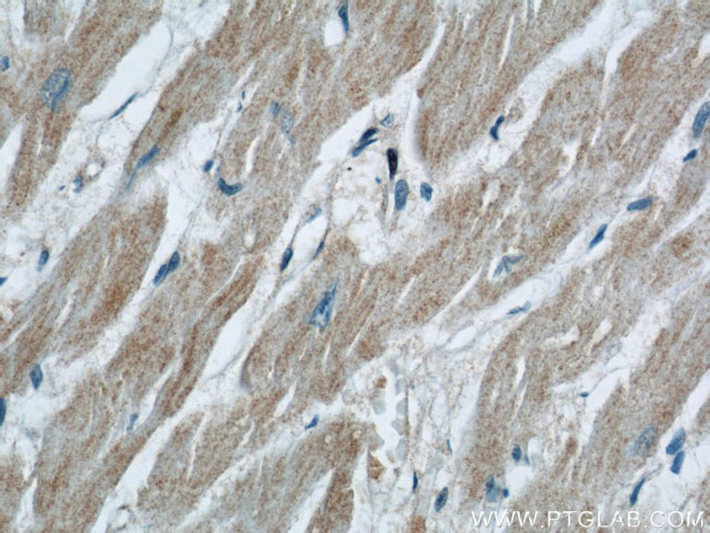 ZFYVE16 Antibody in Immunohistochemistry (Paraffin) (IHC (P))