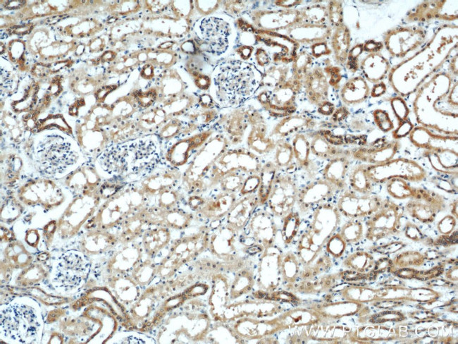 ZFYVE16 Antibody in Immunohistochemistry (Paraffin) (IHC (P))