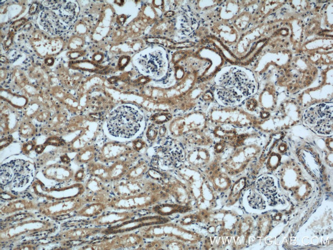 ZFYVE16 Antibody in Immunohistochemistry (Paraffin) (IHC (P))