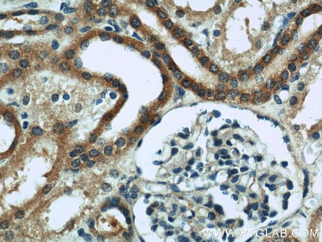 ZFYVE16 Antibody in Immunohistochemistry (Paraffin) (IHC (P))