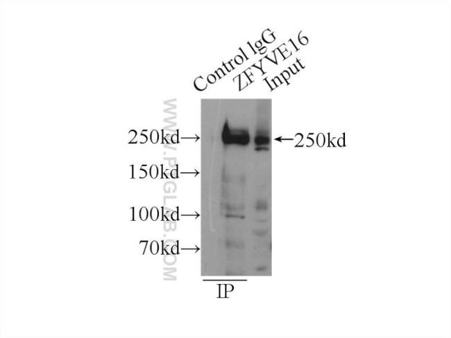 ZFYVE16 Antibody in Immunoprecipitation (IP)