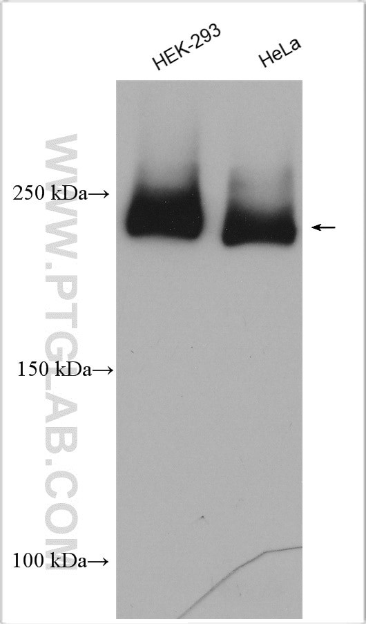 ZFYVE16 Antibody in Western Blot (WB)