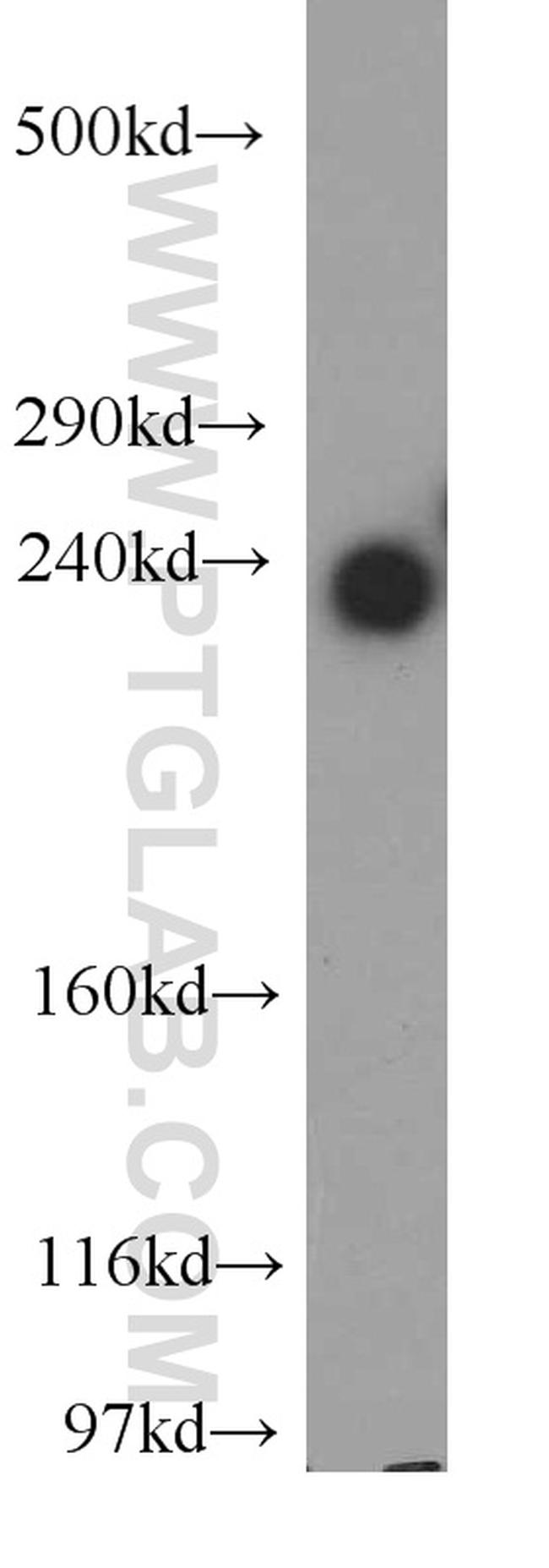 ZFYVE16 Antibody in Western Blot (WB)