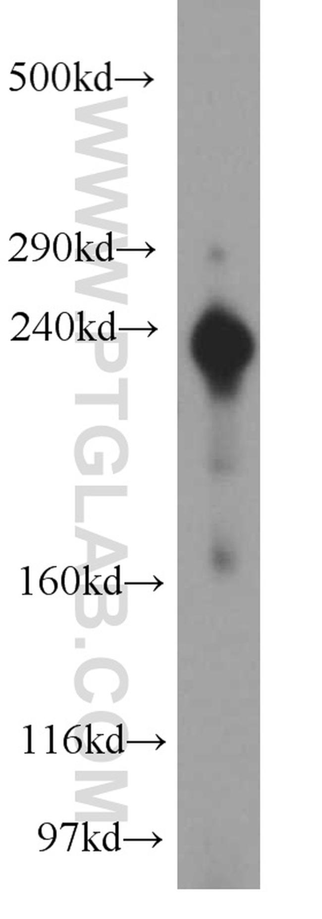 ZFYVE16 Antibody in Western Blot (WB)