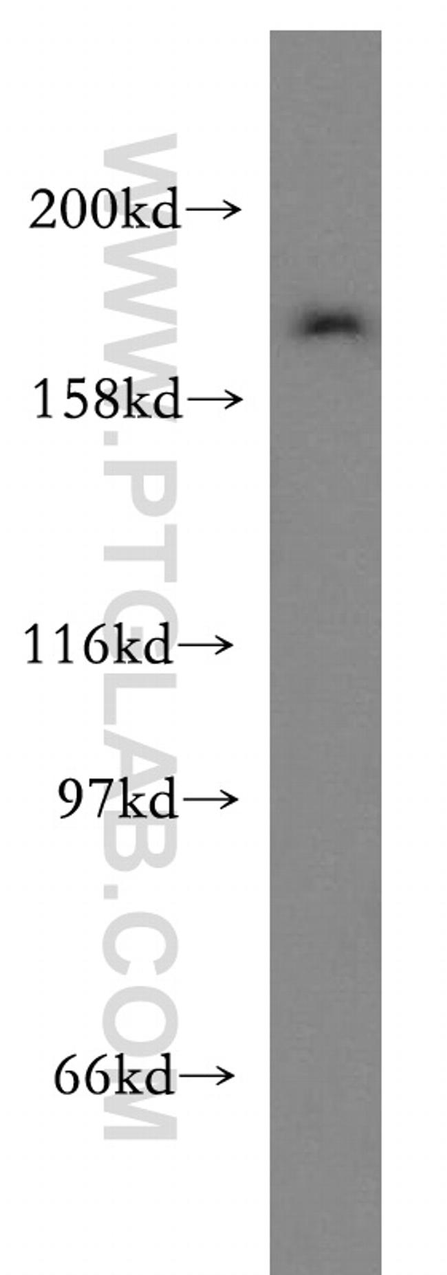 ZFYVE16 Antibody in Western Blot (WB)