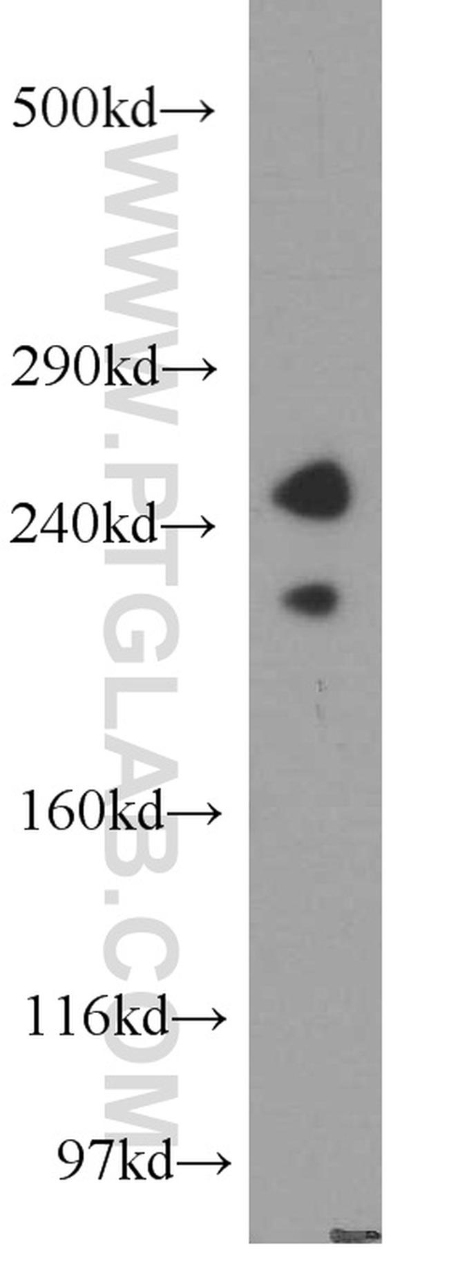 ZFYVE16 Antibody in Western Blot (WB)