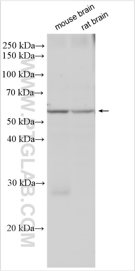 PDE1B Antibody in Western Blot (WB)