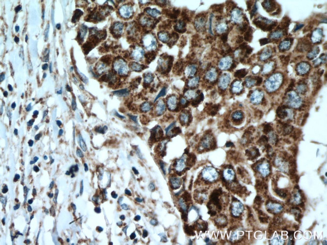 ACADSB Antibody in Immunohistochemistry (Paraffin) (IHC (P))