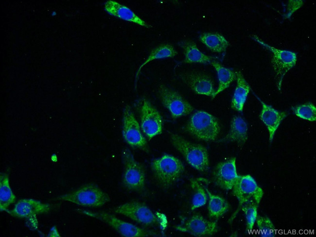 PPP2R2B Antibody in Immunocytochemistry (ICC/IF)