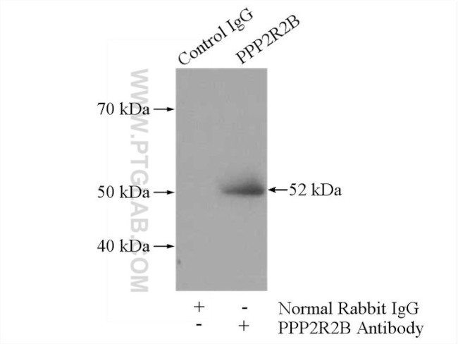 PPP2R2B Antibody in Immunoprecipitation (IP)