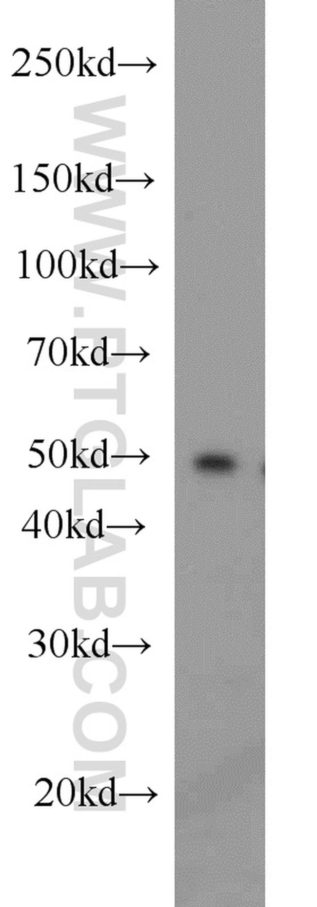 PPP2R2B Antibody in Western Blot (WB)