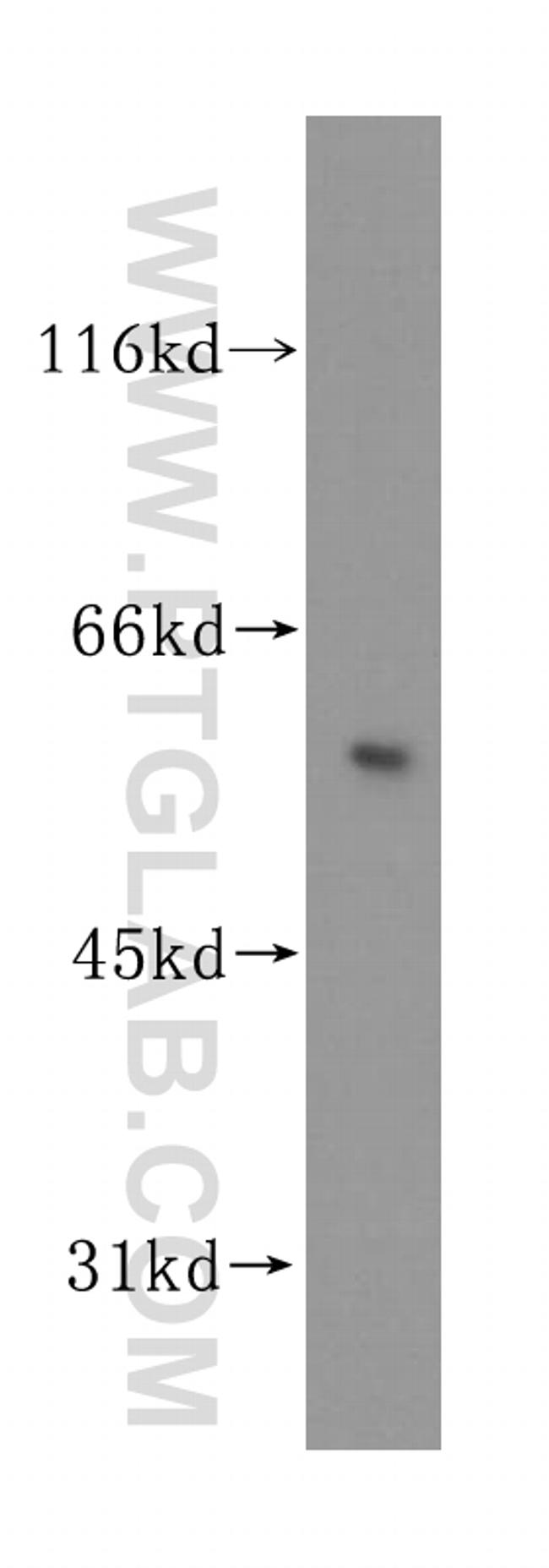 PPP2R2B Antibody in Western Blot (WB)