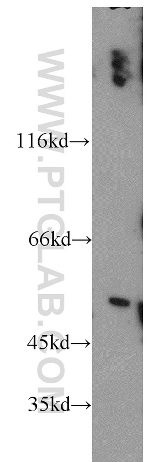 PPP2R2B Antibody in Western Blot (WB)