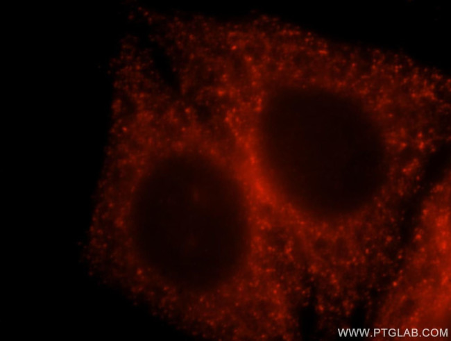 USP24 Antibody in Immunocytochemistry (ICC/IF)