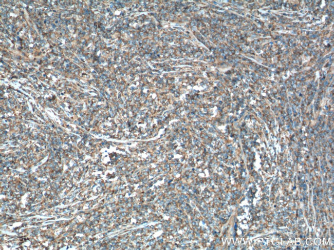 USP24 Antibody in Immunohistochemistry (Paraffin) (IHC (P))