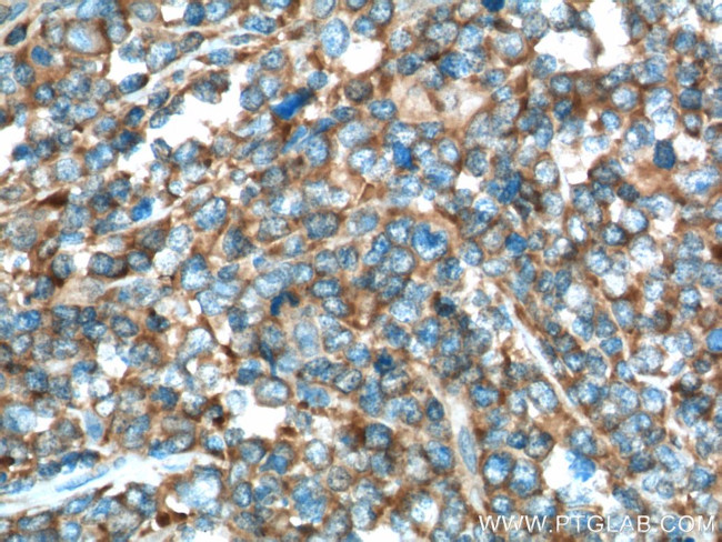 USP24 Antibody in Immunohistochemistry (Paraffin) (IHC (P))