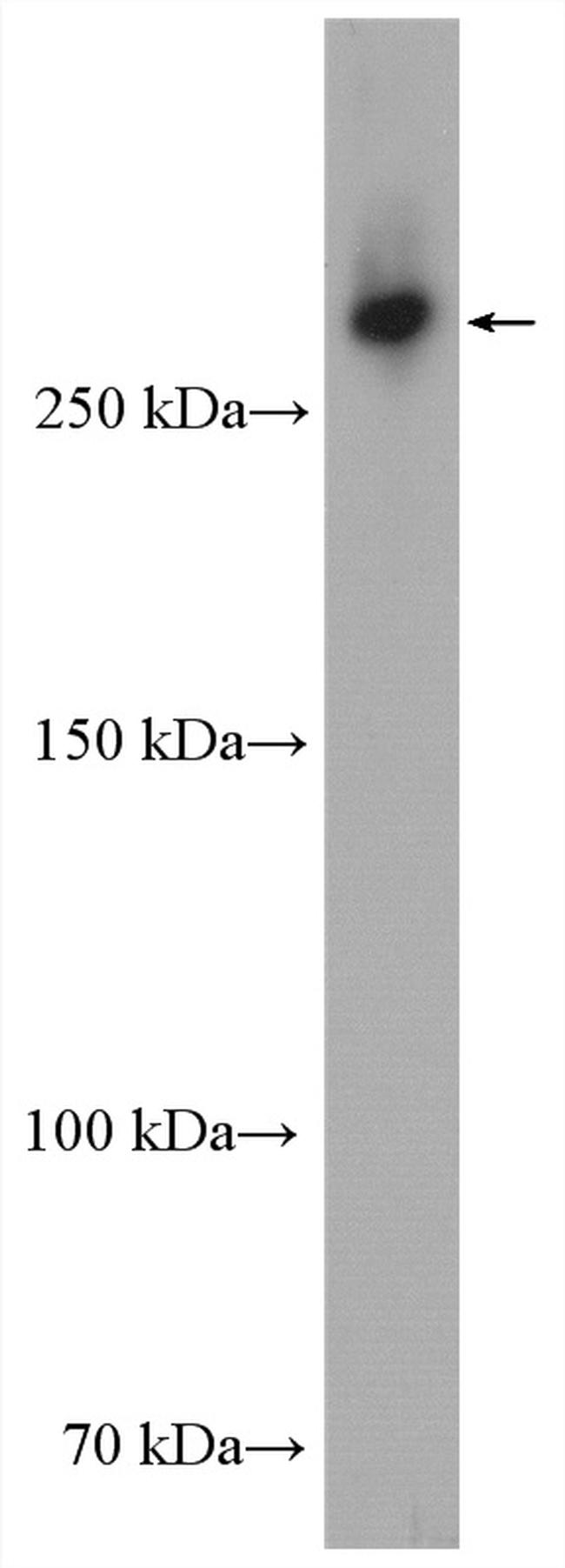 USP24 Antibody in Western Blot (WB)