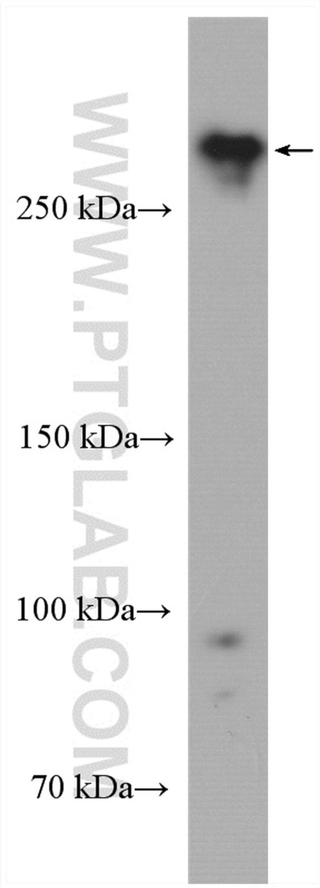 USP24 Antibody in Western Blot (WB)