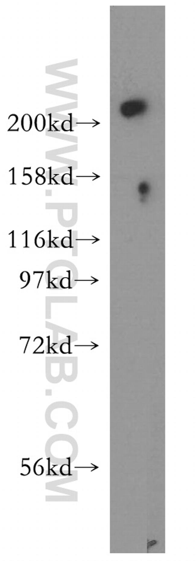 USP24 Antibody in Western Blot (WB)