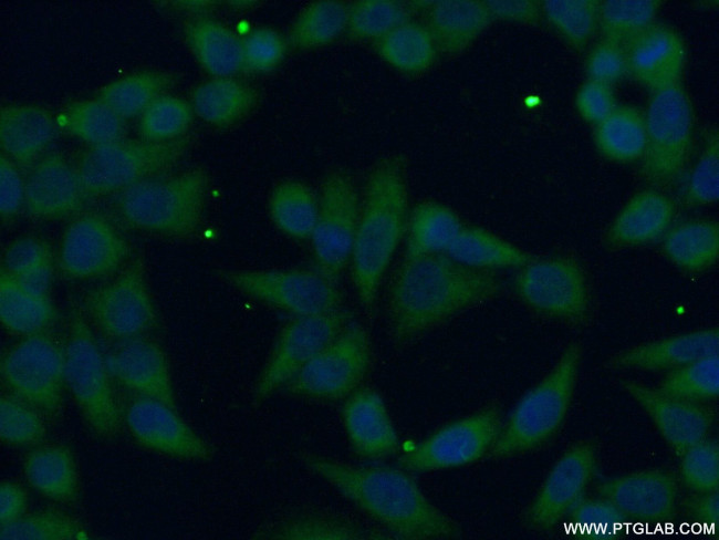 FDFT1 Antibody in Immunocytochemistry (ICC/IF)