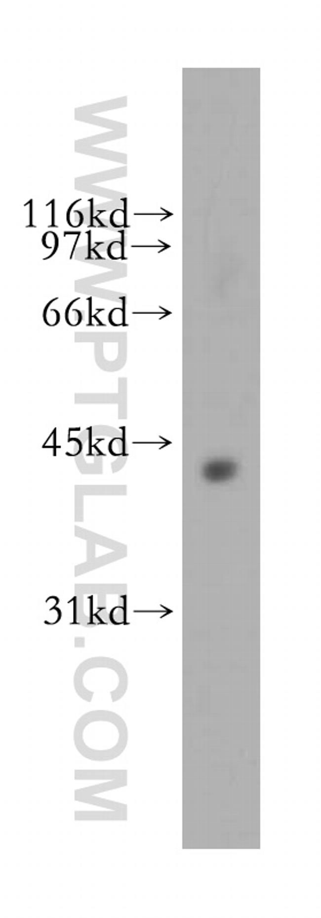 FDFT1 Antibody in Western Blot (WB)