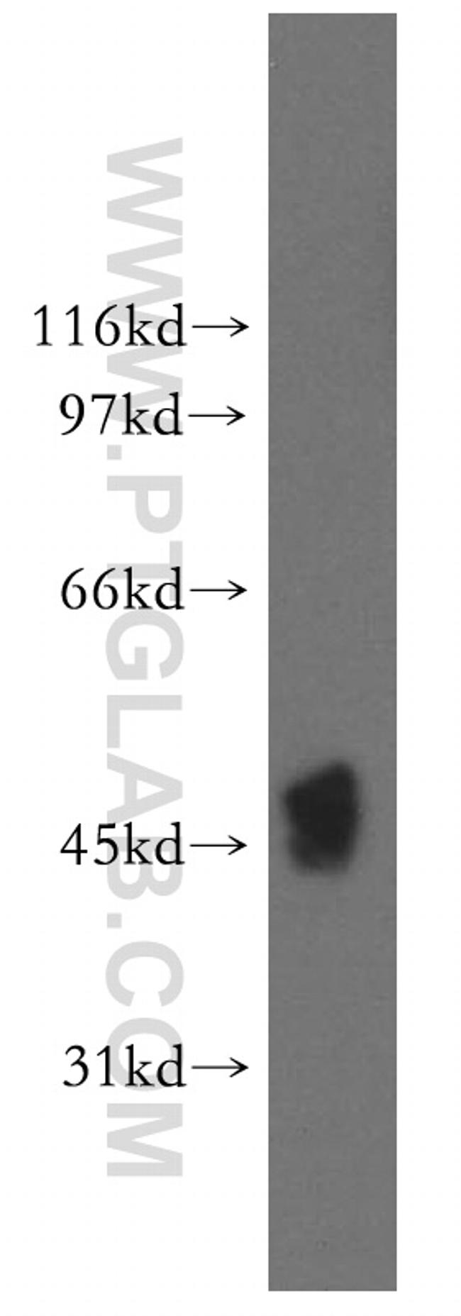 FDFT1 Antibody in Western Blot (WB)