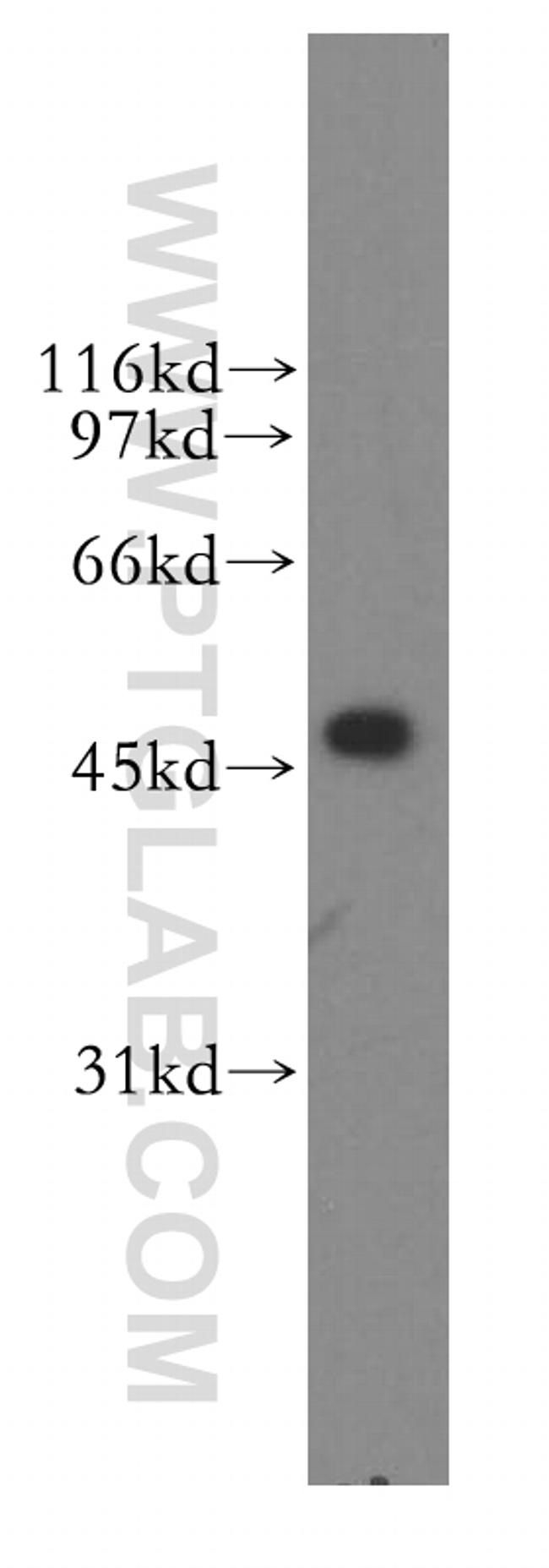 FDFT1 Antibody in Western Blot (WB)