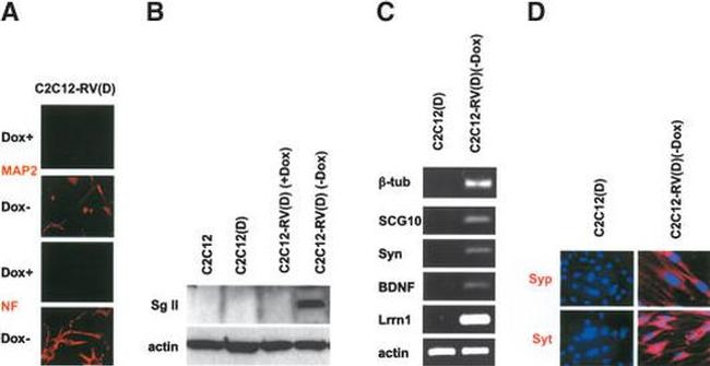 NEFH Antibody in Immunocytochemistry (ICC/IF)