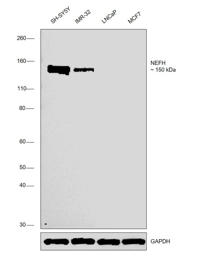 NEFH Antibody in Western Blot (WB)