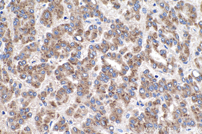 ULBP2 Antibody in Immunohistochemistry (Paraffin) (IHC (P))