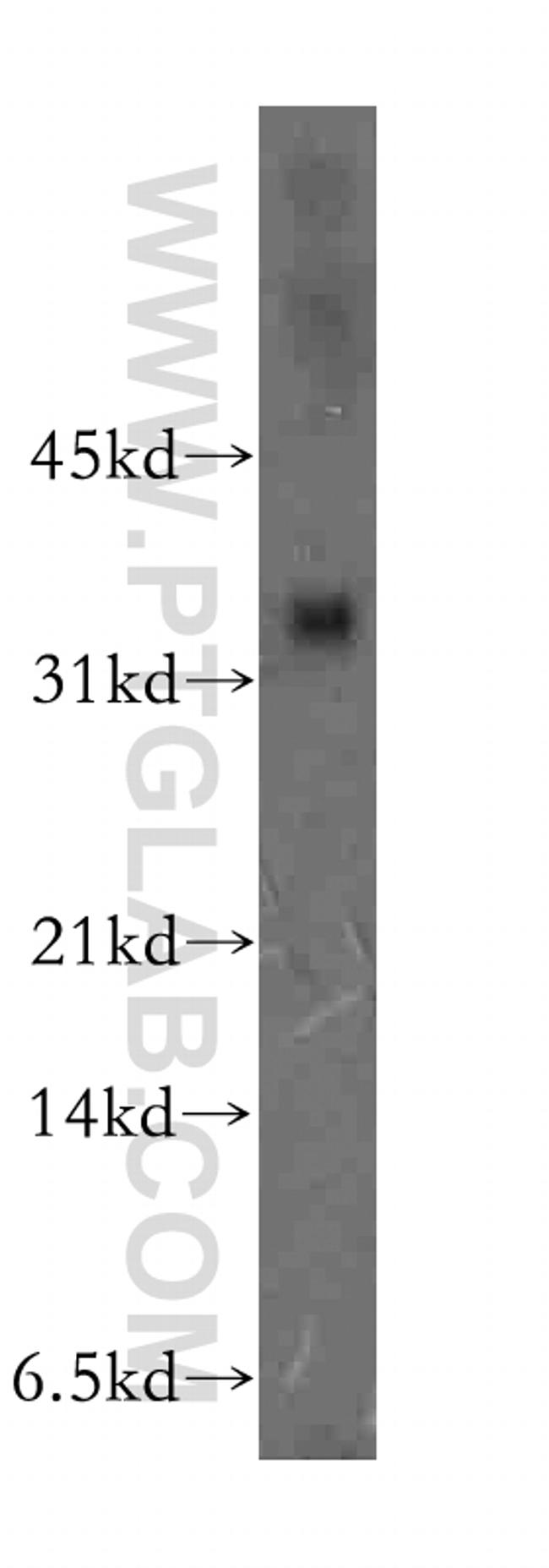 ULBP2 Antibody in Western Blot (WB)