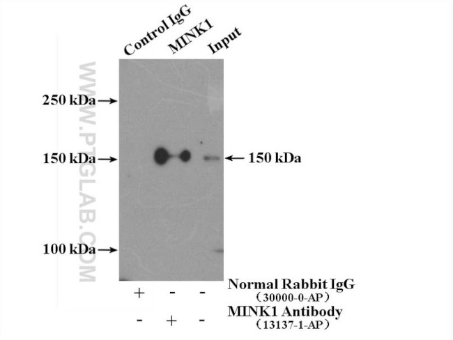 MINK1 Antibody in Immunoprecipitation (IP)