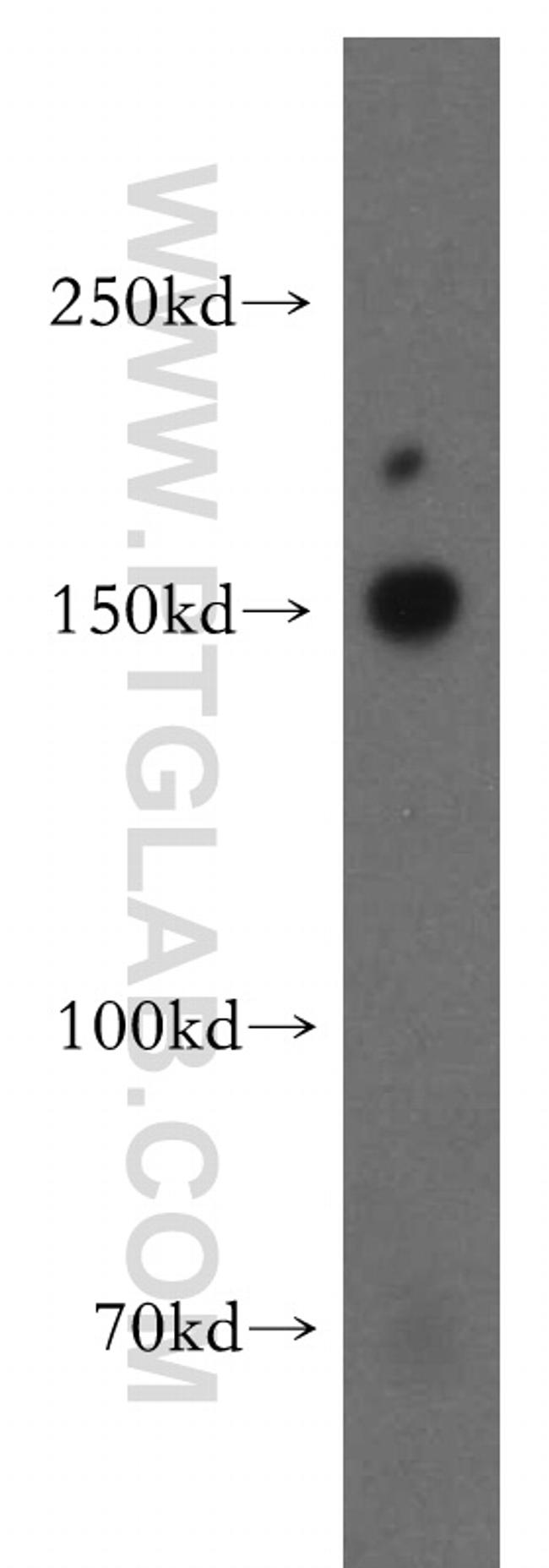 MINK1 Antibody in Western Blot (WB)