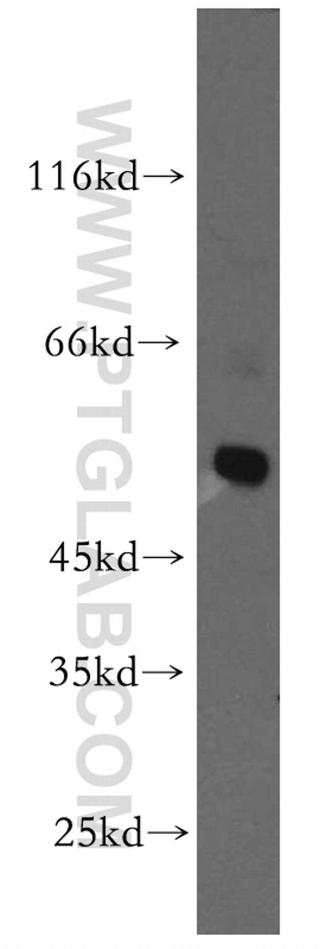 GLRA3 Antibody in Western Blot (WB)