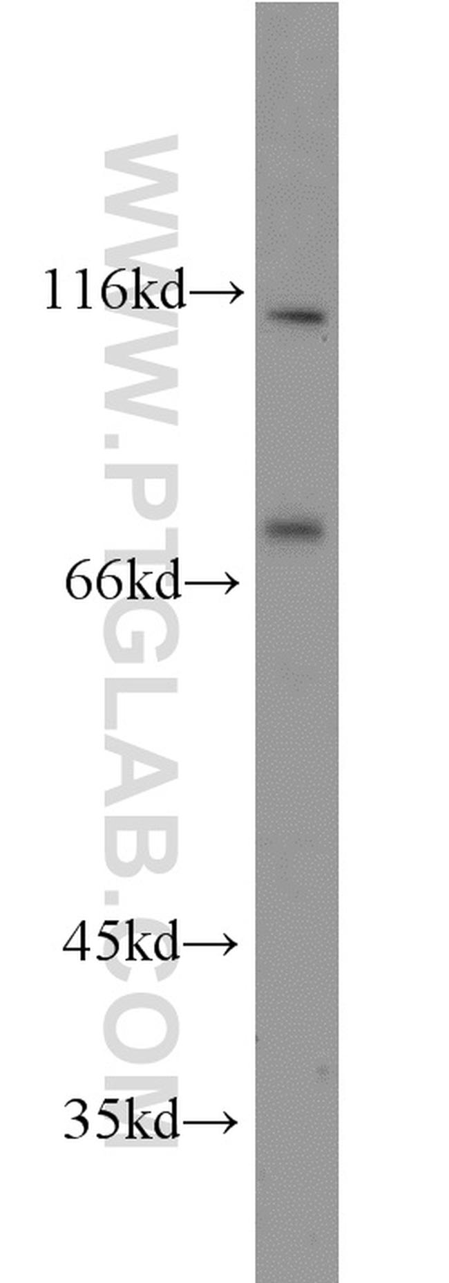 FOXM1 Antibody in Western Blot (WB)