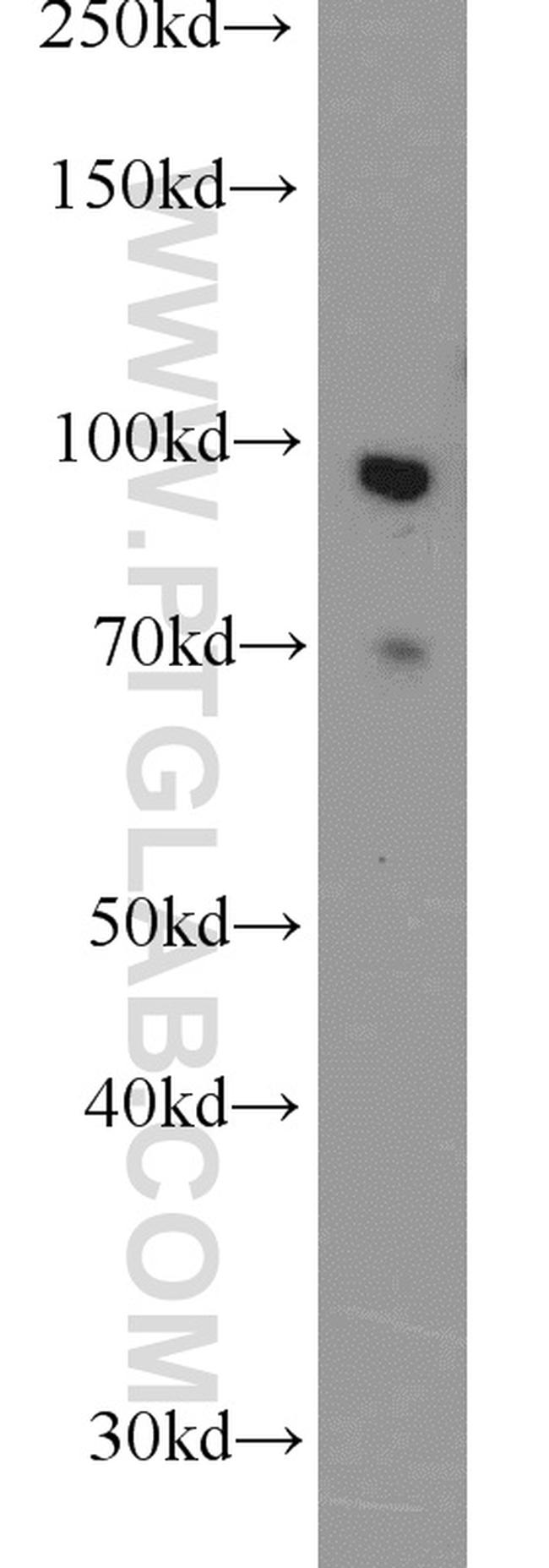 FOXM1 Antibody in Western Blot (WB)