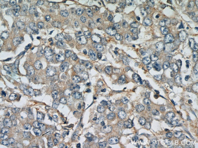 FBXW11 Antibody in Immunohistochemistry (Paraffin) (IHC (P))