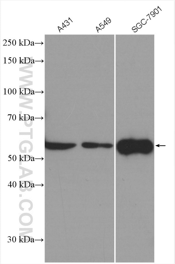 FBXW11 Antibody in Western Blot (WB)