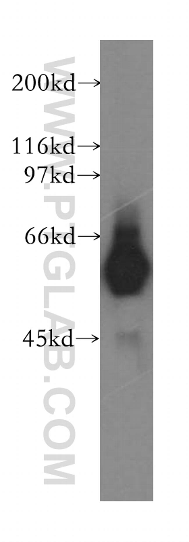 FBXW11 Antibody in Western Blot (WB)