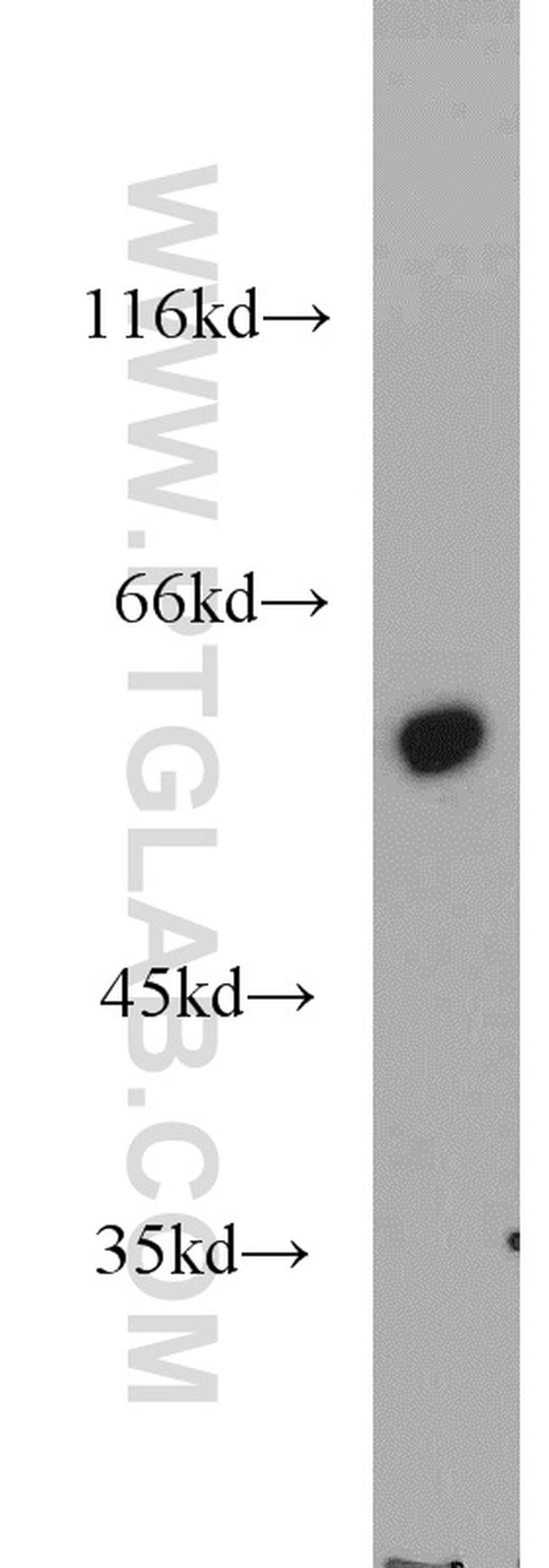 FBXW11 Antibody in Western Blot (WB)