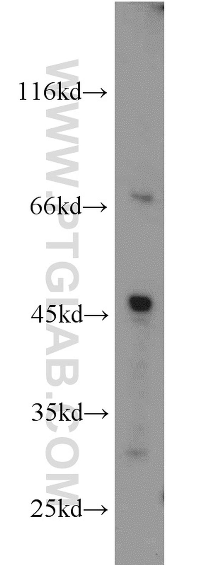 GYG2 Antibody in Western Blot (WB)