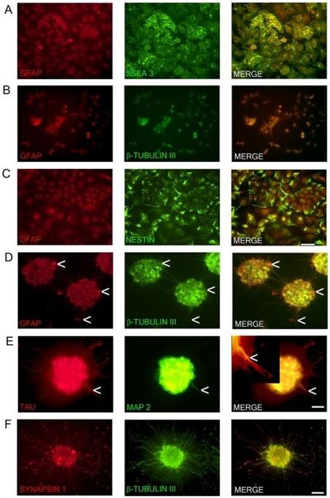 MAP2 Antibody in Immunocytochemistry (ICC/IF)